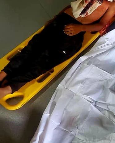 أحد ضحايا هجوم الحوثي بطائرة مسيرة في حجة