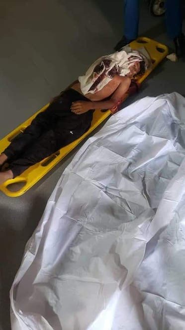 أحد ضحايا هجوم الحوثي بطائرة مسيرة في حجة