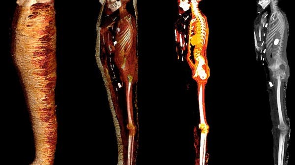 صبي ذهبي مصري عمره 2300 عام .. علماء يكشفون مفاجآت داخل جثته المحنطة!