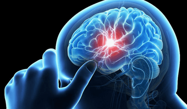 اعراض التهاب الاعصاب في الرأس