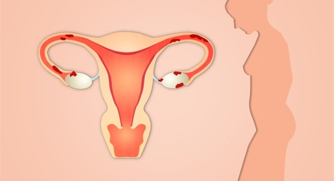 معرفة الحمل عن طريق شكل المهبل
