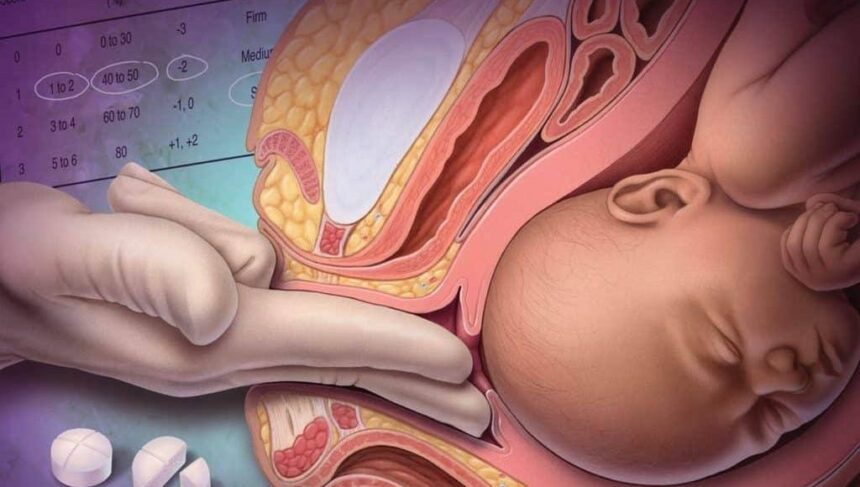 توسيع الرحم باليد للولادة