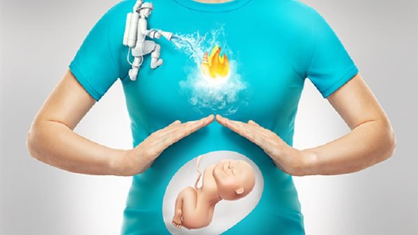 علاج الحموضة عند الحامل في الشهور الأولى