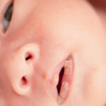 علامات الجفاف عند الرضع