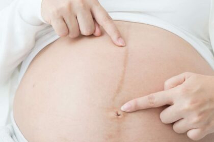 كيف أعرف جنس الجنين من شكل البطن