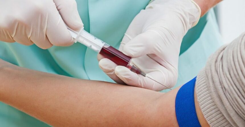 متى يتم عمل تحليل الحمل في الدم؟