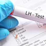 هل ارتفاع هرمون LH يمنع الحمل ويسبب العقم