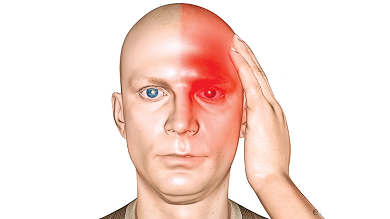 أسباب الصداع النصفي مع ألم العين