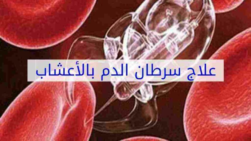 علاج سرطان الدم بالاعشاب