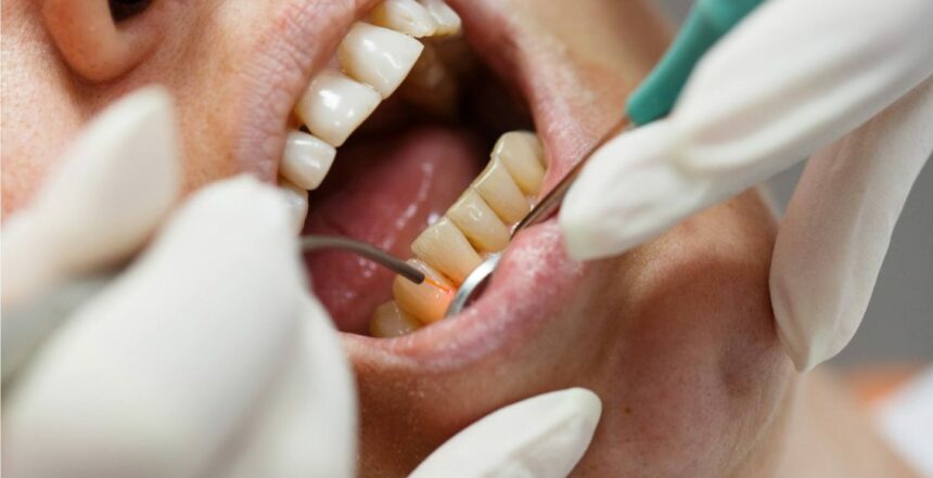 علاج انحسار اللثة وتخلخل الأسنان