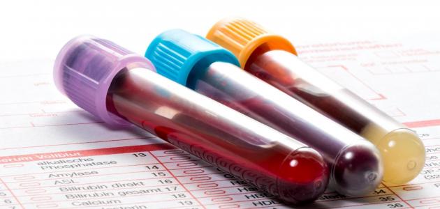 هل تحليل الدم العادي للحمل يخطئ