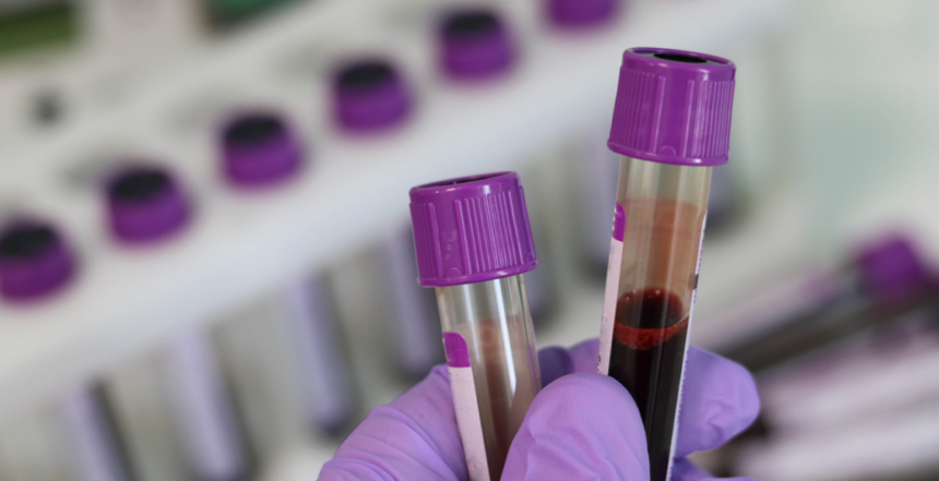هل كل أنواع السرطان تظهر في تحليل الدم