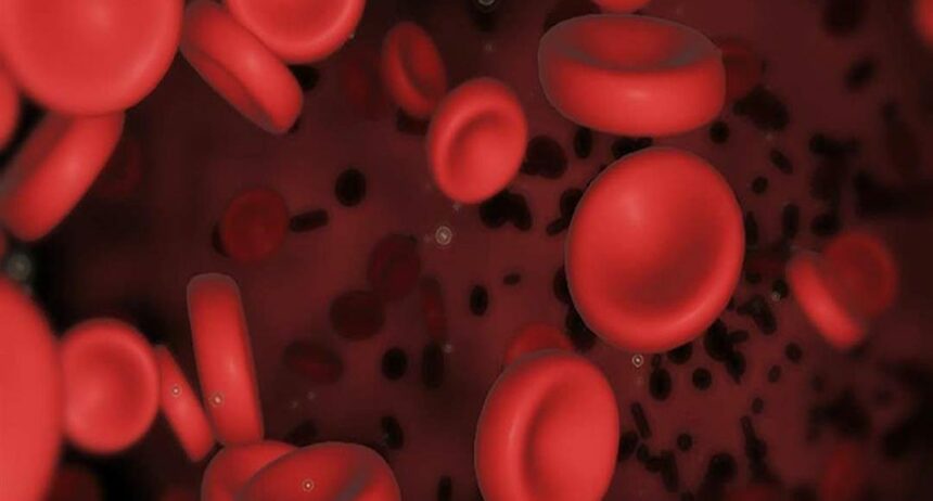 أسباب نقص كريات الدم الحمراء