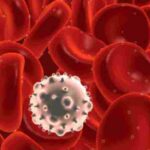 اعراض سرطان الدم الليمفاوي