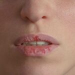ما هي أسباب جفاف الفم وعلاجه؟