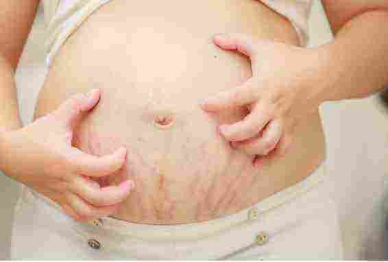 هل الحكة من أعراض الحمل المبكرة
